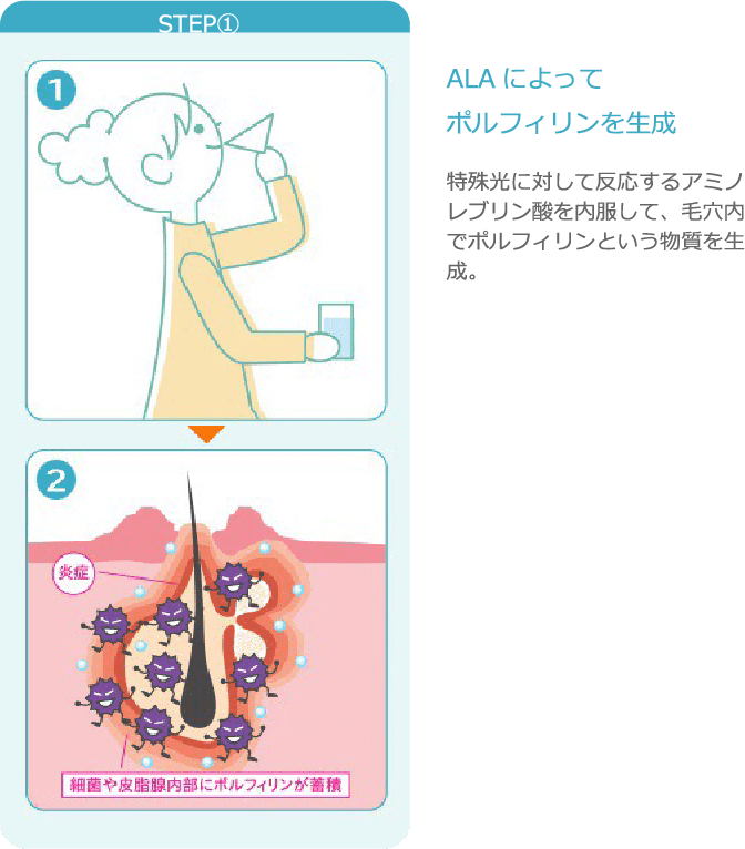 STEP① ALAによってポルフィリンを生成